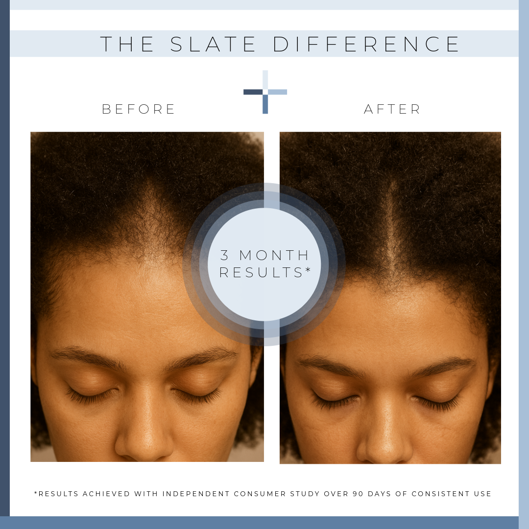 Spectrum Rebalance Scalp Serum