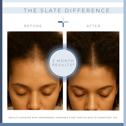 Spectrum Rebalance Scalp Serum